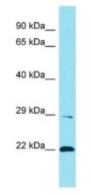 Western Blot: LENG1 Antibody [NBP3-09745]