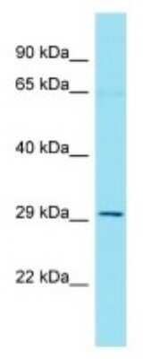 Western Blot: LENG1 Antibody [NBP3-09746]