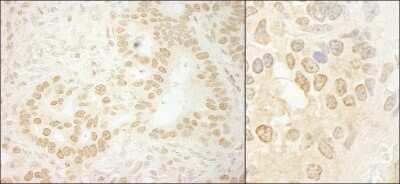 Immunohistochemistry: LEO1 Antibody [NB600-276]
