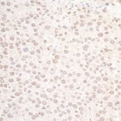 Immunohistochemistry: LEO1 Antibody [NB600-276]