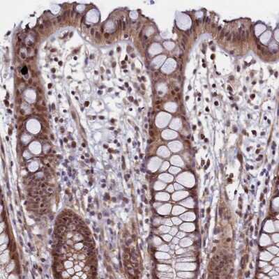 Immunohistochemistry-Paraffin: LEO1 Antibody [NBP1-86236]