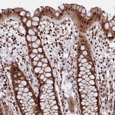 Immunohistochemistry-Paraffin: LEO1 Antibody [NBP1-89423]