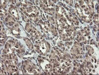 Immunohistochemistry: LEPRE1 Antibody (OTI1H3) [NBP2-45786]