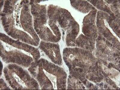 Immunohistochemistry: LEPRE1 Antibody (OTI1H3) [NBP2-45786]