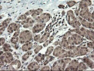 Immunohistochemistry: LEPRE1 Antibody (OTI1H3) [NBP2-45786]