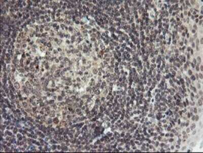 Immunohistochemistry: LEPRE1 Antibody (OTI1H3) [NBP2-45786]