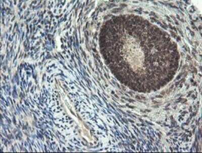 Immunohistochemistry: LEPRE1 Antibody (OTI1H3) [NBP2-45786]