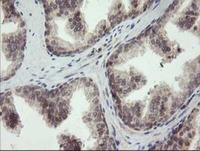Immunohistochemistry: LEPRE1 Antibody (OTI1H3) [NBP2-45786]
