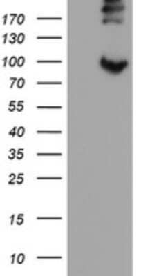 Western Blot: LEPRE1 Antibody (OTI1H3) [NBP2-45786]