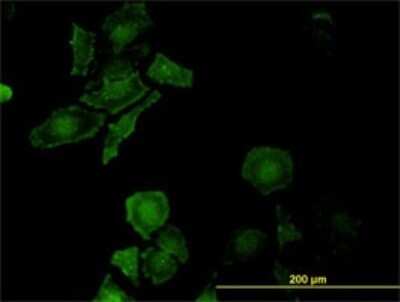 Immunocytochemistry/ Immunofluorescence: LEPRE1 Antibody (3C7) [H00064175-M01]