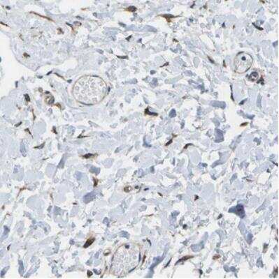 Immunohistochemistry: LEPRE1 Antibody [NBP2-30460]