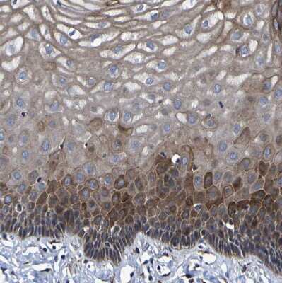 Immunohistochemistry-Paraffin: LEPRE1 Antibody [NBP2-30424]