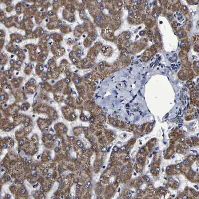 Immunohistochemistry-Paraffin: LEPRE1 Antibody [NBP2-30424]