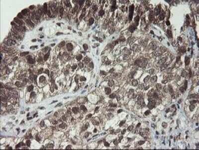 Immunohistochemistry: LEPRE1 Antibody (OTI1H3) - Azide and BSA Free [NBP2-72134]