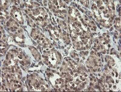 Immunohistochemistry: LEPRE1 Antibody (OTI1H3) - Azide and BSA Free [NBP2-72134]