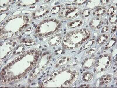 Immunohistochemistry: LEPRE1 Antibody (OTI1H3) - Azide and BSA Free [NBP2-72134]