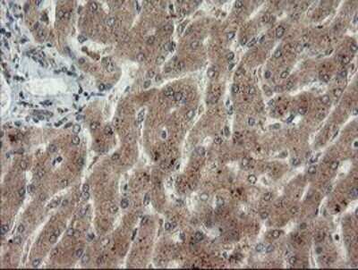 Immunohistochemistry: LEPRE1 Antibody (OTI1H3) - Azide and BSA Free [NBP2-72134]