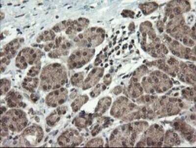 Immunohistochemistry: LEPRE1 Antibody (OTI1H3) - Azide and BSA Free [NBP2-72134]