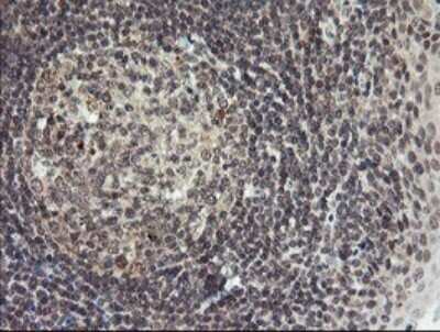 Immunohistochemistry: LEPRE1 Antibody (OTI1H3) - Azide and BSA Free [NBP2-72134]