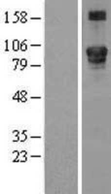 Western Blot: LEPRE1 Overexpression Lysate [NBL1-12491]