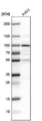 Western Blot: LEPREL1 Antibody [NBP1-94041]