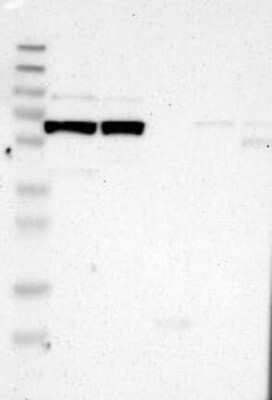 Western Blot: LEPREL1 Antibody [NBP3-17877]