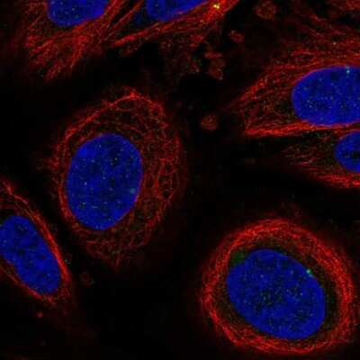 Immunocytochemistry/ Immunofluorescence: LEPROT Antibody [NBP2-57596]