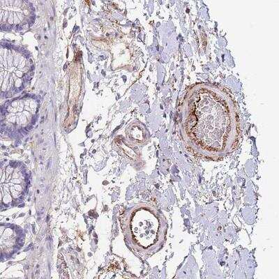 Immunohistochemistry-Paraffin: LEPROTL1 Antibody [NBP2-14626]