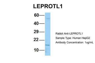 Western Blot: LEPROTL1 Antibody [NBP2-83143]