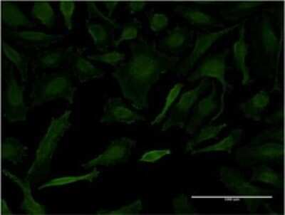 Immunocytochemistry/ Immunofluorescence: LETM1 Antibody (2C6) [H00003954-M02]