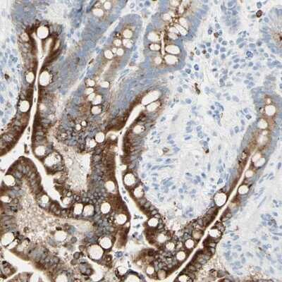 Immunohistochemistry-Paraffin: LETM1 Antibody [NBP1-86482]