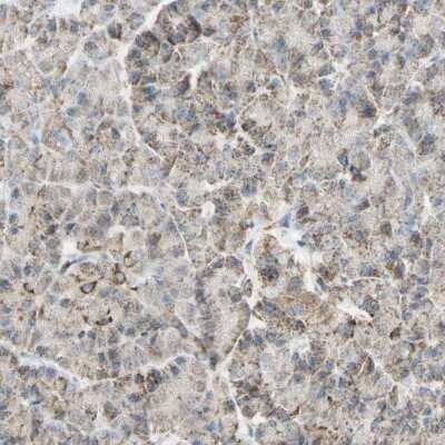 Immunohistochemistry-Paraffin: LETM1 Antibody [NBP1-89556]
