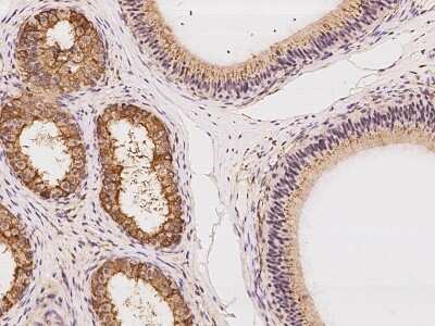 Immunohistochemistry: LETM2 Antibody [NBP2-97437]