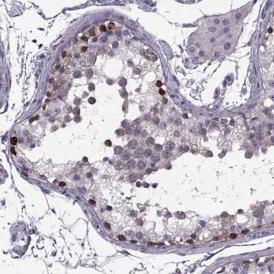 Immunohistochemistry-Paraffin: LETM2 Antibody [NBP1-83563]