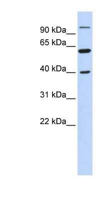 Western Blot: LETM2 Antibody [NBP1-56618]