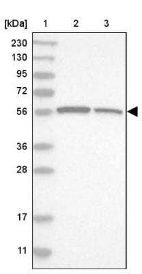 Western Blot: LETM2 Antibody [NBP1-83563]