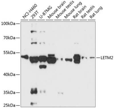 Western Blot: LETM2 AntibodyAzide and BSA Free [NBP3-04901]