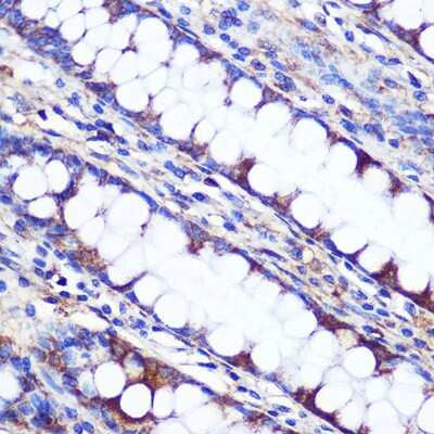 Immunohistochemistry-Paraffin: LETMD1 Antibody - BSA Free [NBP3-04759]