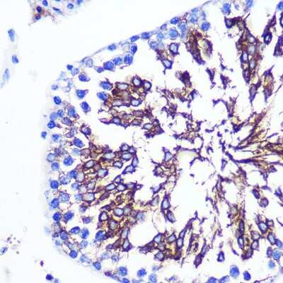 Immunohistochemistry-Paraffin: LETMD1 Antibody - BSA Free [NBP3-04759]