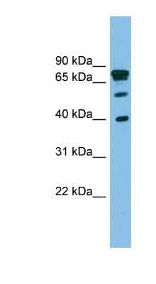 Western Blot: LETMD1 Antibody [NBP1-59843]