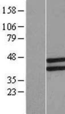 Western Blot: LETMD1 Overexpression Lysate [NBL1-12495]