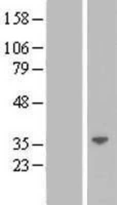 Western Blot: Galectin-12 Overexpression Lysate [NBL1-12497]