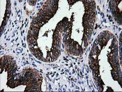 Immunohistochemistry-Paraffin: Galectin-3BP/MAC-2BP/LGALS3BP Antibody (OTI6B7) [NBP2-01160]