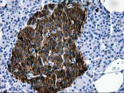 Immunohistochemistry-Paraffin: Galectin-3BP/MAC-2BP/LGALS3BP Antibody (OTI6B7) [NBP2-01160]