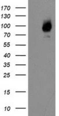 Western Blot: Galectin-3BP/MAC-2BP/LGALS3BP Antibody (OTI6B7) [NBP2-01160]