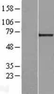 Western Blot: Galectin-3BP/MAC-2BP/LGALS3BP Overexpression Lysate [NBL1-12502]