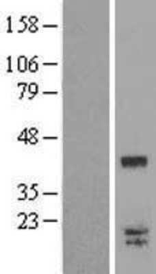 Western Blot: Galectin-9C Overexpression Lysate [NBL1-12625]