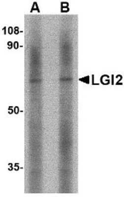 Western Blot: LGI2 AntibodyBSA Free [NBP1-76886]