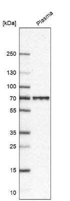 Western Blot: LGI2 Antibody [NBP1-83839]