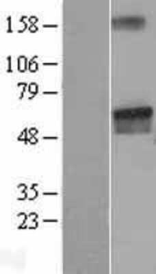 Western Blot: LGI2 Overexpression Lysate [NBL1-12507]